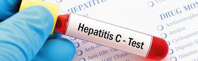 28 DE JULIO, DÍA MUNDIAL DE LA HEPATITIS 