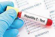 28 de Julio, Día Mundial de la Hepatitis